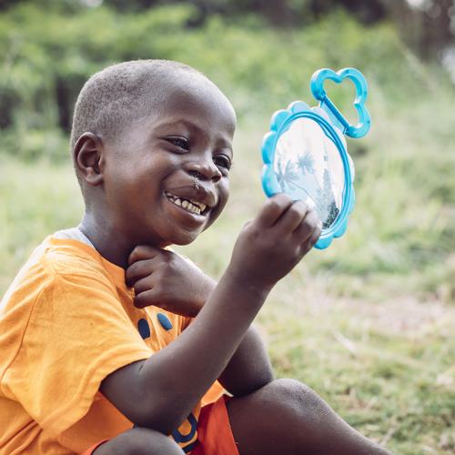 child with mended cleft lip